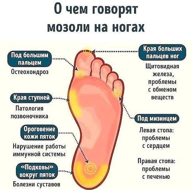 1585475642.jpg