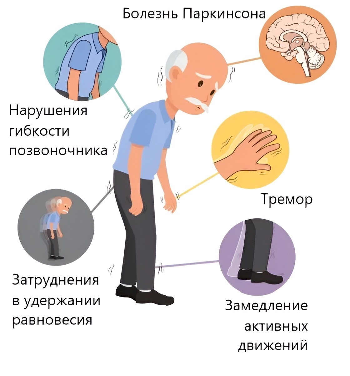болезнь Паркинсона и псилоцибин.jpg