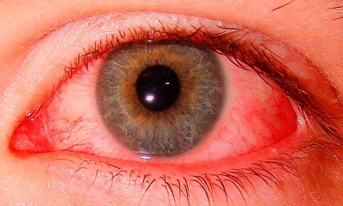 marihuana glaza.jpg