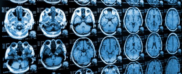 mriscansofbrain-1-scaled.jpg