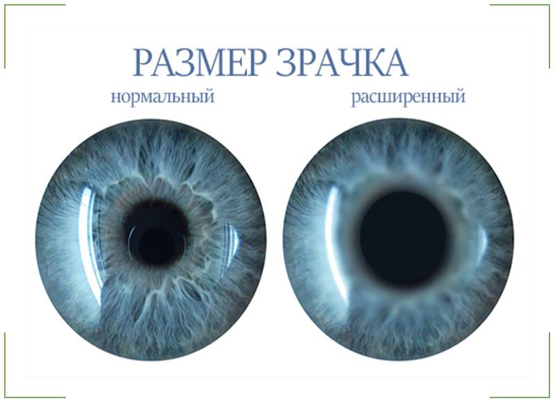 размер зрачков от амфа мефа шиш.jpg