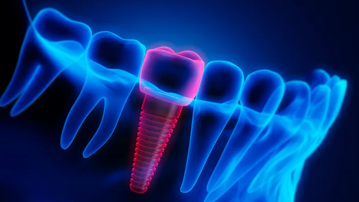 Screenshot 2023-05-29 at 13-56-24 AI in dentistry Researchers find that artificial intelligenc...png