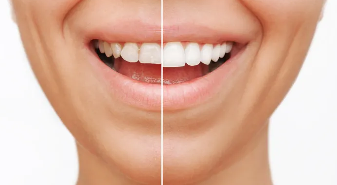 Screenshot 2023-05-29 at 14-00-27 AI in dentistry Researchers find that artificial intelligenc...png