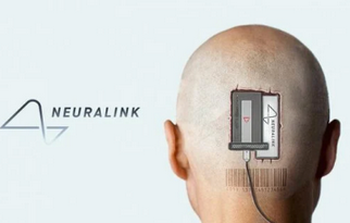 Screenshot 2024-03-26 at 12-28-48 Мужчина с имплантом Neuralink написал пост в соцсети силой м...png