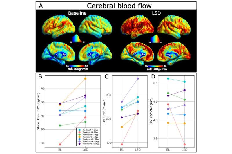 study-explores-how-lsd-1.jpg