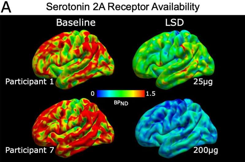 study-explores-how-lsd.jpg