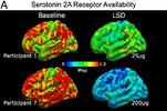 study-explores-how-lsd.jpg